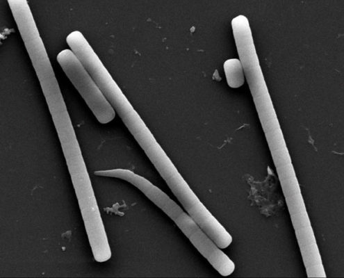 Scanning electron microscopy of a filamentous cyanobacterium